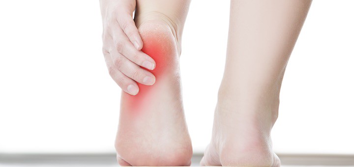 heel pain after jogging